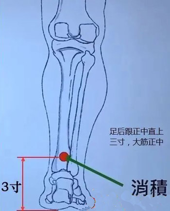 倪海厦：判断肿瘤的奇穴——消积穴-第1张图片-中国中医健康网